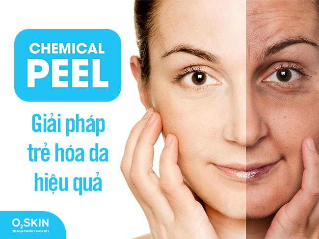 Chemical Peel - giải pháp trẻ hóa da hiệu quả cho làn da sau 30.