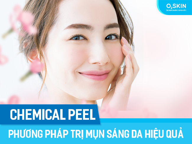 Chemical Peel (Peel da) là phương pháp trị mụn sáng da hiệu quả.