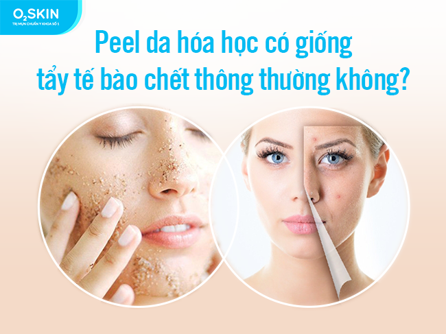 Sau khi Peel da làn da của bạn sẽ nhanh chóng được phục hồi