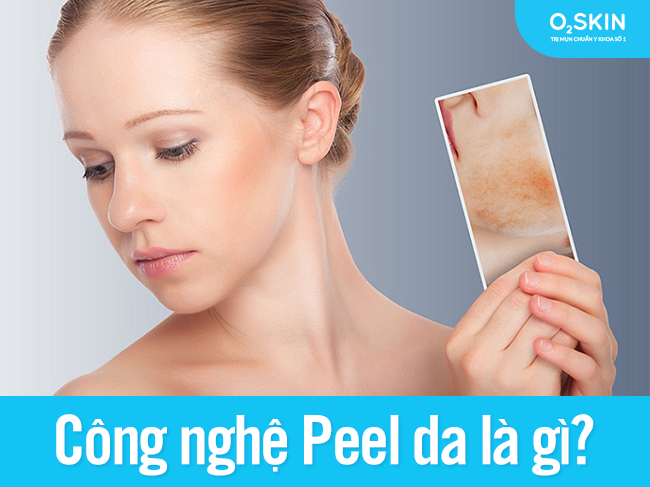 Peel da là một công nghê dùng hóa chất tác động lên bề mặt da.