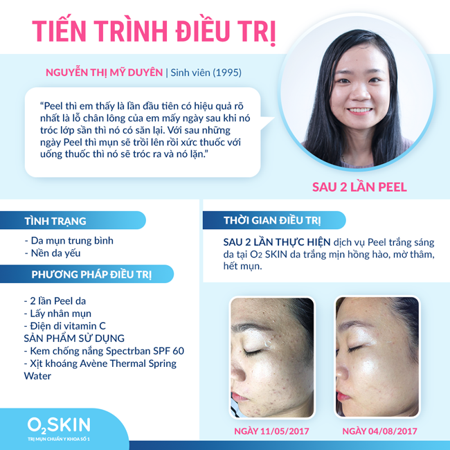 Quy trình 10 bước chuẩn Y khoa Peel trị mụn - mờ thâm - trắng da tại O₂ SKIN
