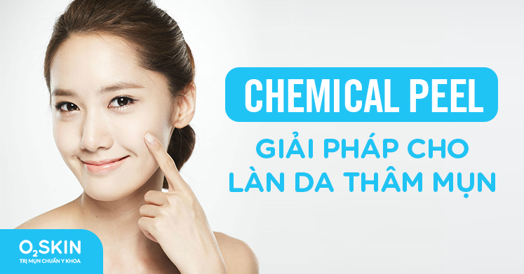 Peel da hay Chemical Peel là phương pháp điều trị mụn phổ biến hiện nay