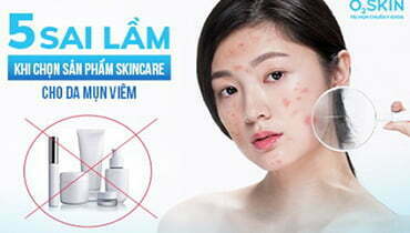 5 Sai Lầm Thường Gặp Khi Chọn Sản Phẩm Skincare Cho Da Mụn Viêm