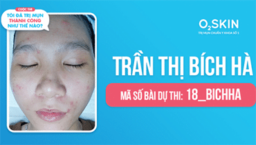 Trần Thị Bích Hà