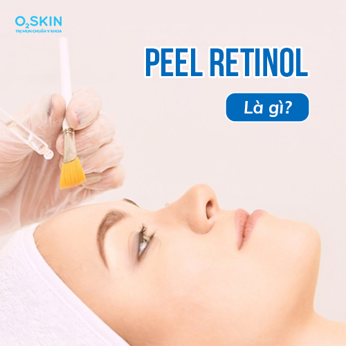 Peel retinol là gì?