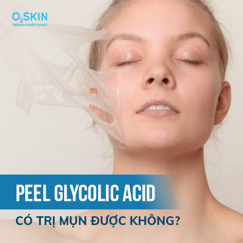 Peel Glycolic Acid là gì? Có trị mụn được không?