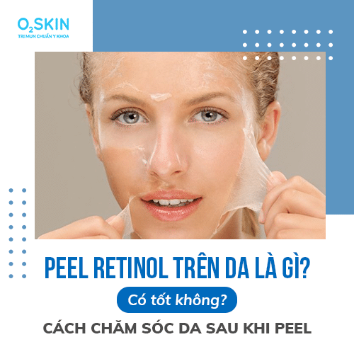 Peel Retinol trên da là gì? Có tốt không? Cách chăm sóc da sau khi Peel da?