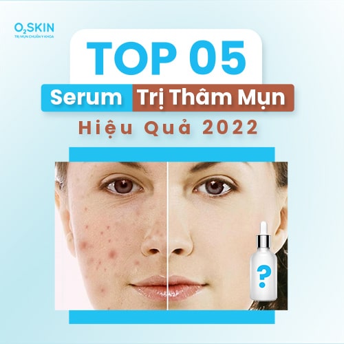 Top 05 serum trị thâm mụn hiệu quả 2022