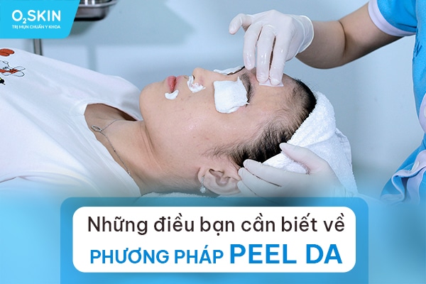Những điều bạn cần biết về phương pháp Peel da