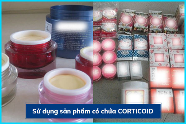 Lạm dụng corticoid với hàm lượng cao trong thời gian dài có thể gây tàn phá làn da.