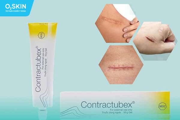 Contractubex có hiệu quả điều trị cao với hầu hết các loại sẹo