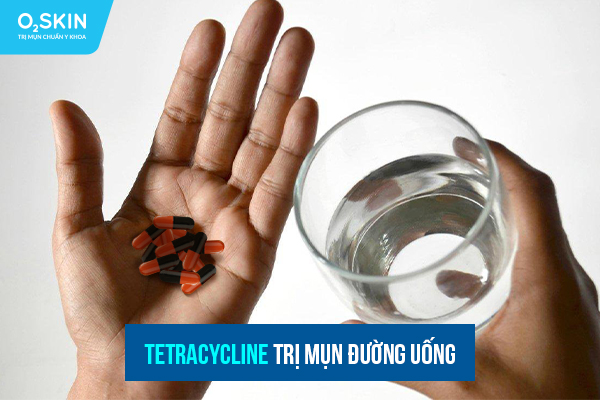 Tetracycline trị mụn đường uống