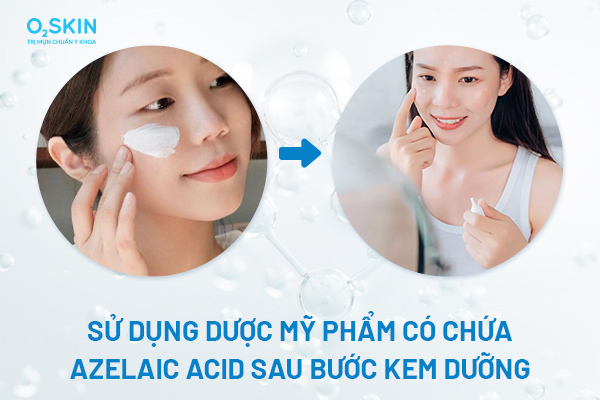 Sử dụng dược mỹ phẩm có chứa Azelaic Acid sau bước kem dưỡng để bảo vệ da
